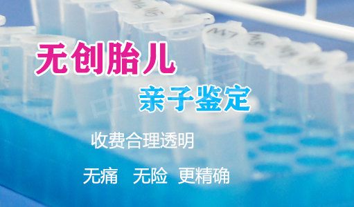 徐州怀孕亲子鉴定需要怎么做,徐州孕期亲子鉴定中心预约 徐州怀孕亲子鉴定需要怎么做,徐州孕期亲子鉴定中心预约